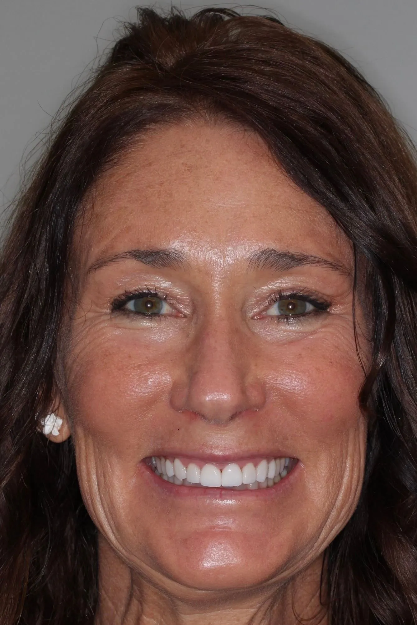 smile-makeover-1-headshot