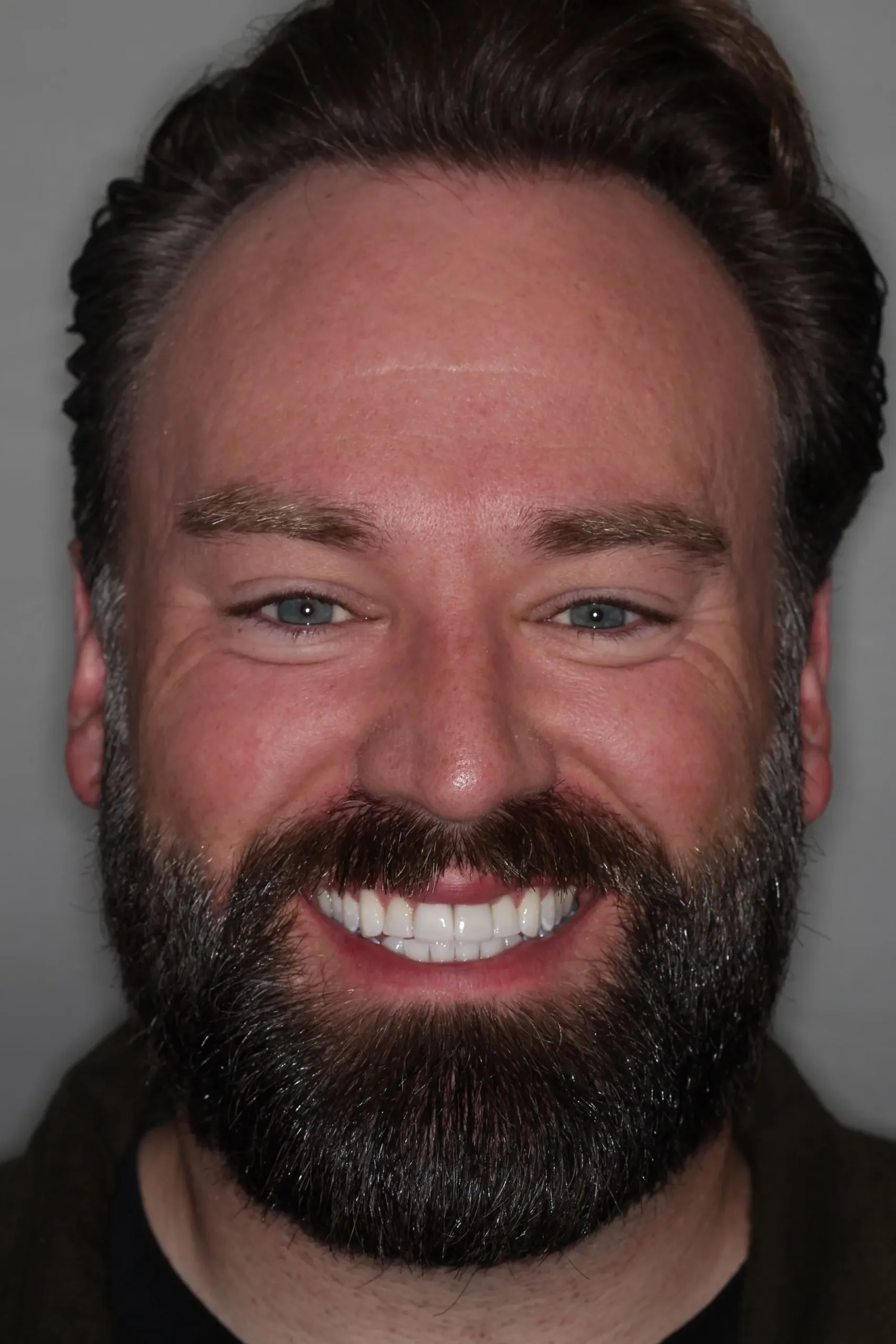 smile-makeover-2-headshot