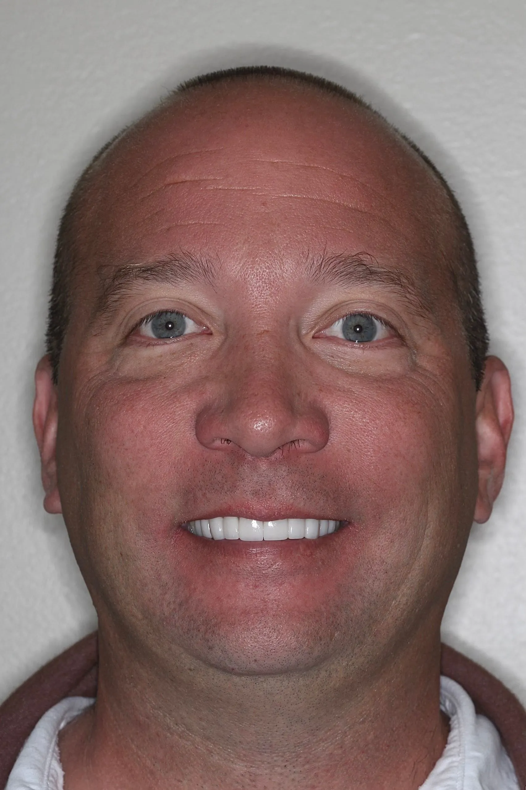 smile-makeover-3-headshot
