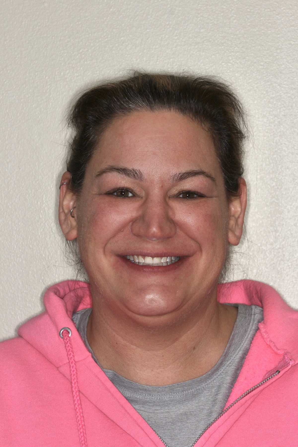 gnwd-invisalign after-june-03 headshot